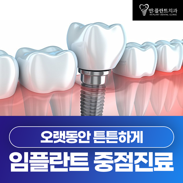 임플란트 중점진료